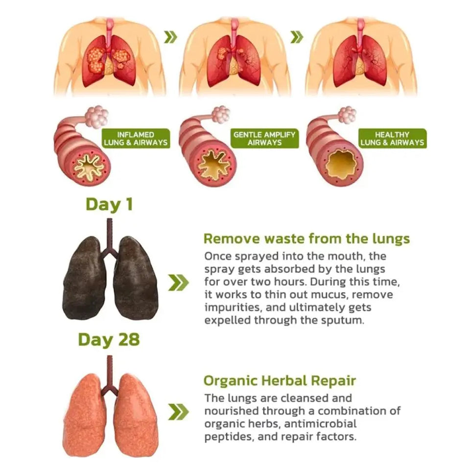 FreshLung™ - Breath Detox Herbal Lung Cleansing Spray