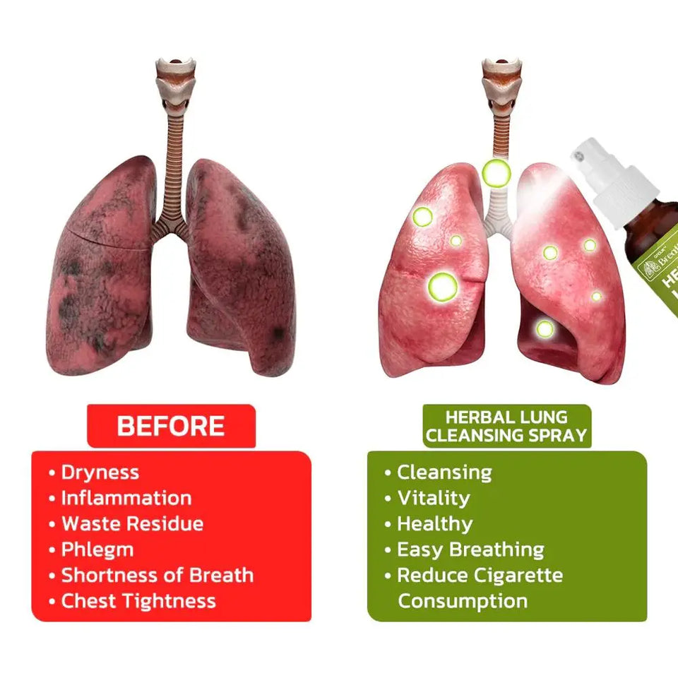 FreshLung™ - Breath Detox Herbal Lung Cleansing Spray