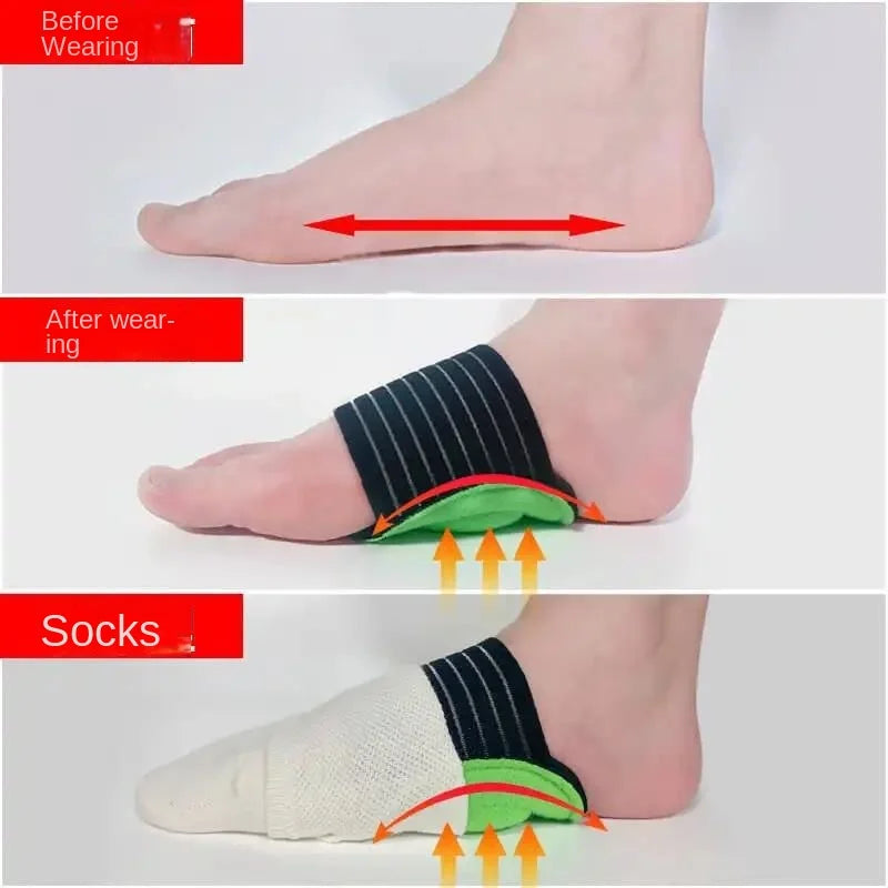 ArchAid™ - Rubbing Insoles